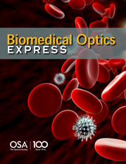 OSA journal